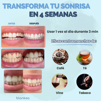 Blankea Dental Pro™ – Tech God Trend